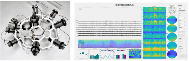 推荐一款好用的脑机接口的中风后主动康复训练解决方案-新通供应链论坛
