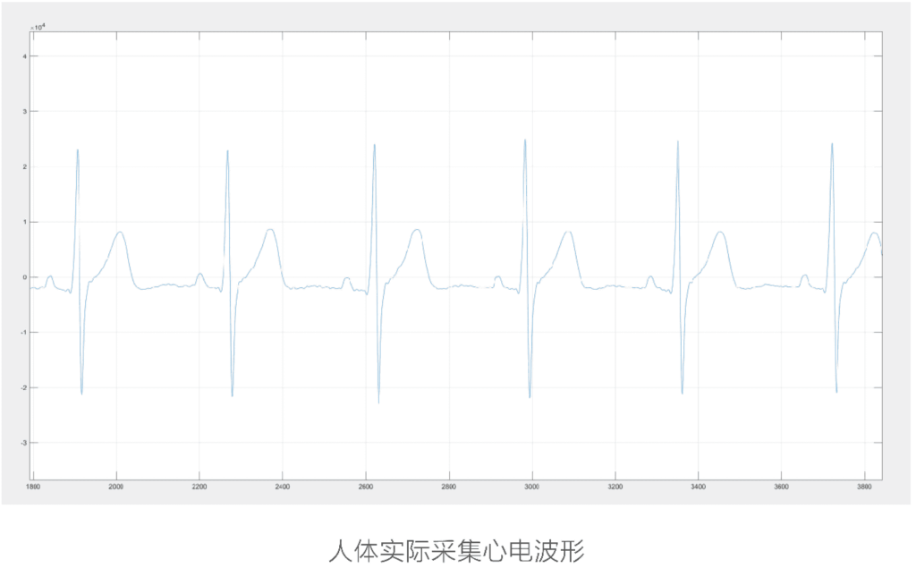 20250611203535443-a21e7c60d8aa6d9253d9354ad54efd16_21E159585153E976F7B855E8E9D05E20_w2521h1564