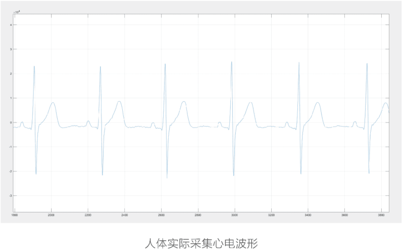 应用于智能马桶国产心电模块-新通供应链论坛