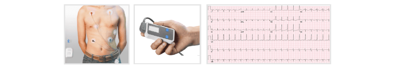 国产化十二导联心电图机-新通供应链论坛