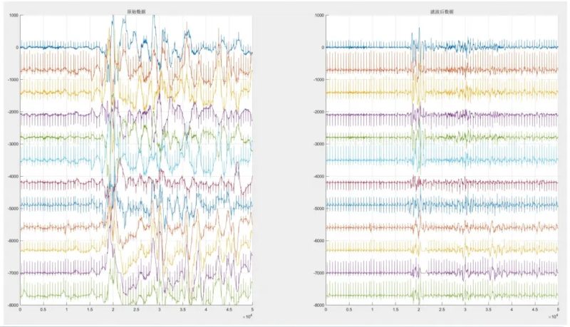 国产化医疗级12导联心电图算法-新通供应链论坛