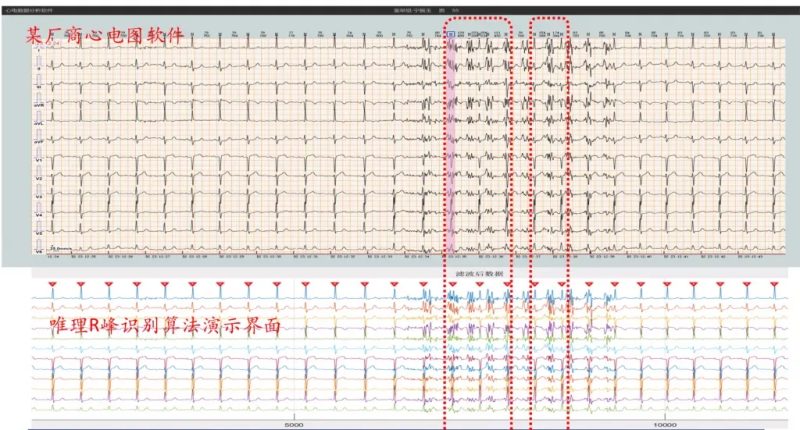 国产化医疗级12导联心电图算法-新通供应链论坛