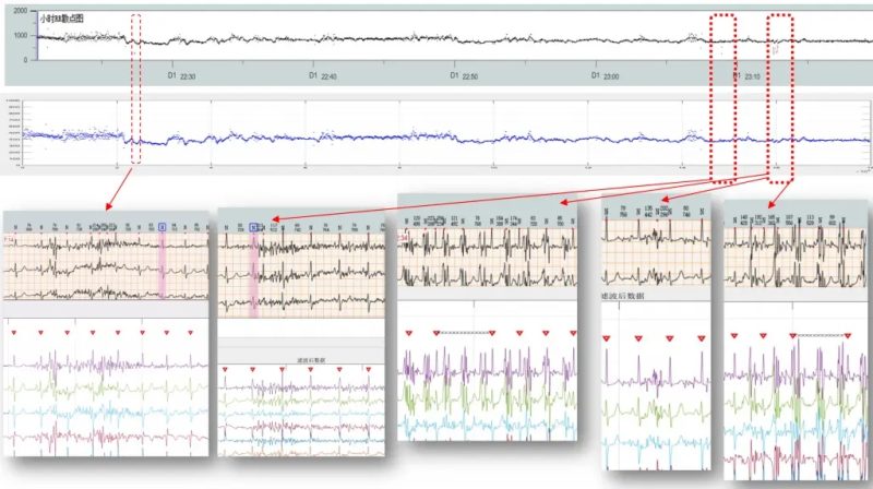 国产化医疗级12导联心电图算法-新通供应链论坛