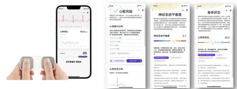 国产化手持单导心电仪技术解决方案-新通供应链论坛