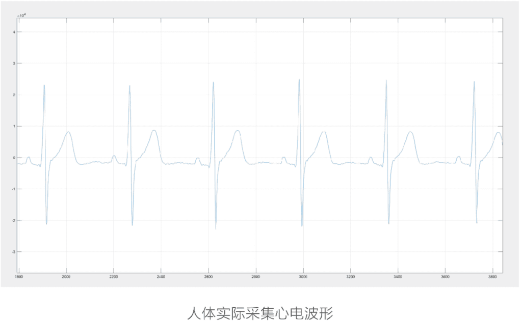 20250620203231729-5c13a82de1fccb600a4ea4e7a3cd31d3_graph22