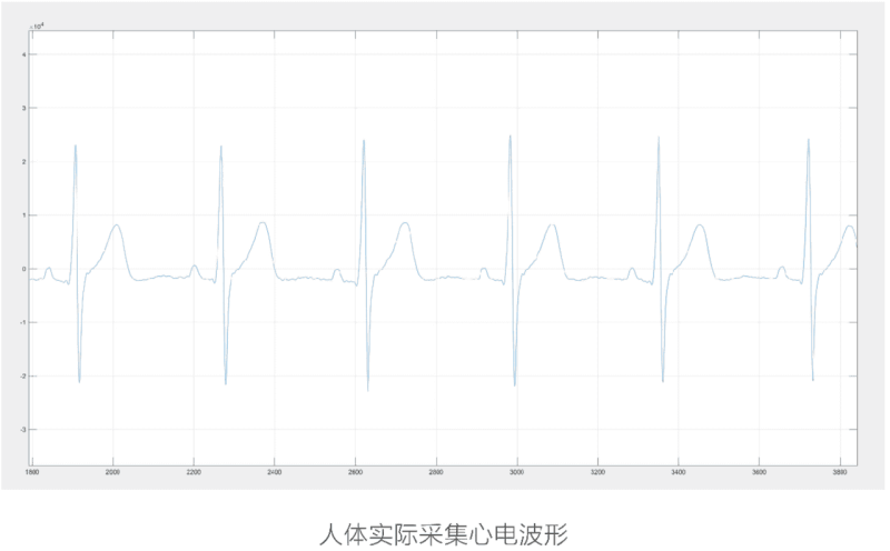 国产医疗级心电ECG采集处理模块-新通供应链论坛