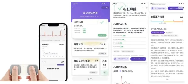 苏州唯理家用心电仪FitCard入驻联通智家-新通供应链论坛